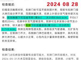 2023.8.29，穿刺活检确诊肺腺癌四期，不能手术。9月5日基因检测ALK融合突变。9月