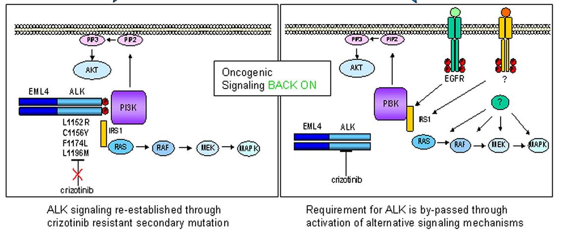 ALK突变耐药原理图.JPG
