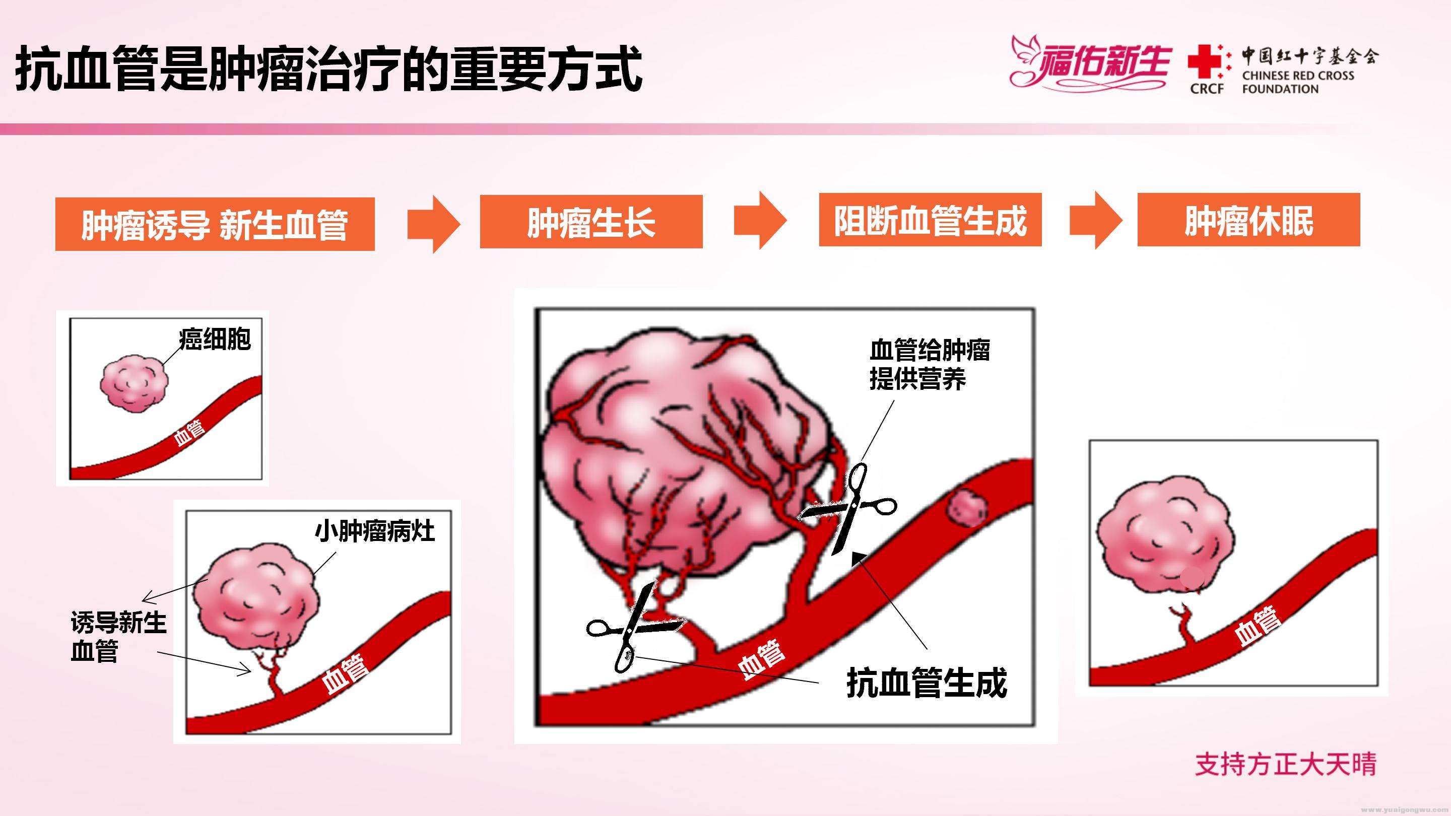 晚期肺癌抗血管靶向治疗-最终正式_05.jpg